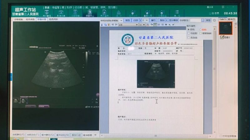 企业体检定制方案：如何精准满足需求，保障健康投资**